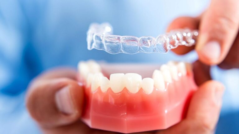 Best Lagacy Dental Clinic in Hyderabad